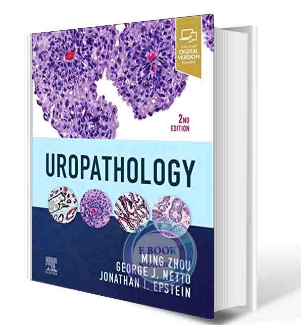 دانلود کتاب Uropathology 2nd Edition 2022 (ORIGINAL PDF )